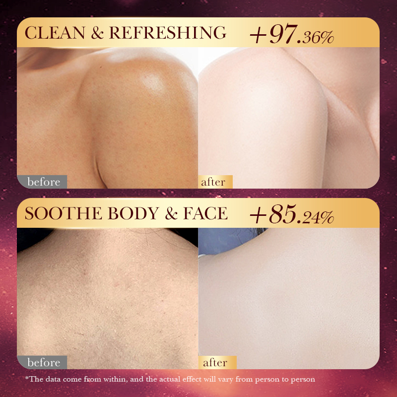Rose Gold Foil Handmade Soap – - Luxury Rose Skincare ulasan dan harga